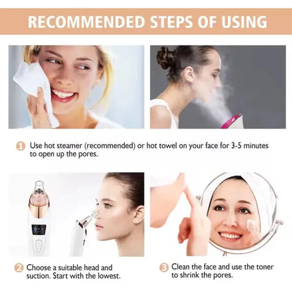 vacuum blackhead remover