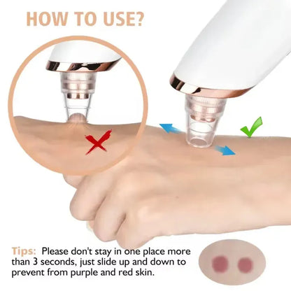 pore vacuum cleaner