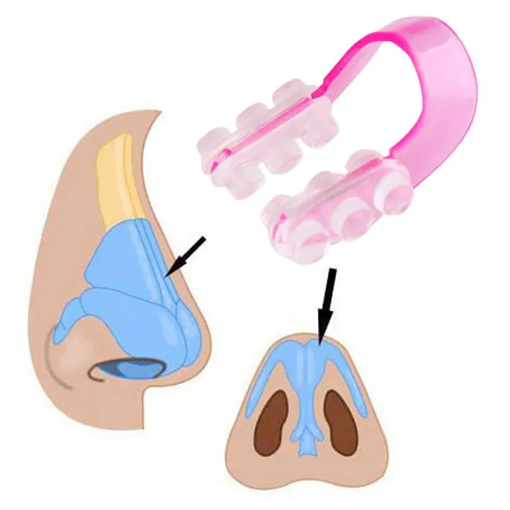 Nose Up Lifter Clip – Nose Bridge Shaping Tool
