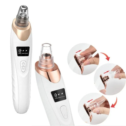 4 in 1 Blackhead Remover – Pore Vacuum Suction Tool