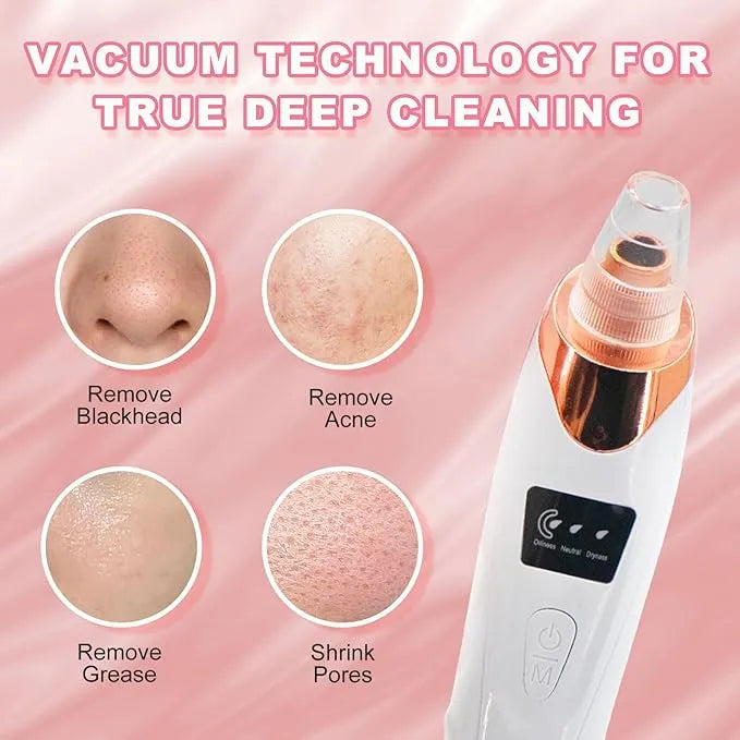 4 in 1 Blackhead Remover – Pore Vacuum Suction Tool