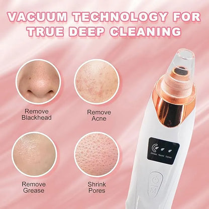 4 in 1 Blackhead Remover – Pore Vacuum Suction Tool